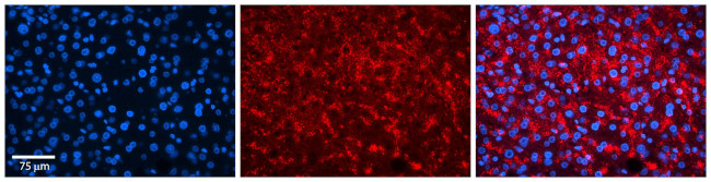 TSPAN31 Antibody in Immunohistochemistry (IHC)