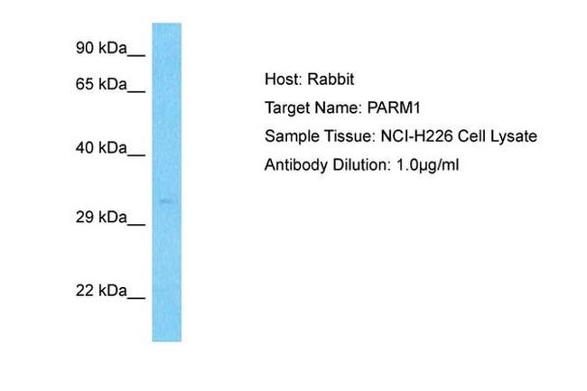 PARM1 Antibody in Western Blot (WB)
