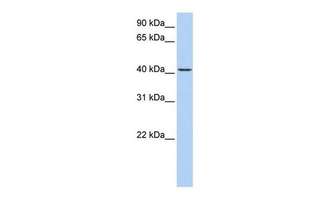 TMEM144 Antibody in Western Blot (WB)