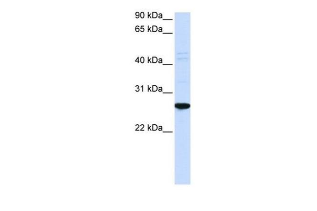 DRGX Antibody in Western Blot (WB)