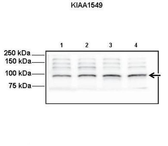 KIAA1549 Antibody in Western Blot (WB)