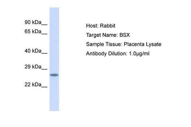 BSX Antibody in Western Blot (WB)