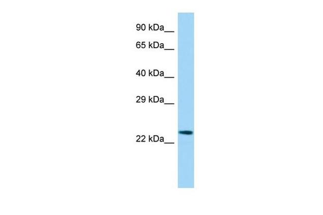 Etv3l Antibody in Western Blot (WB)