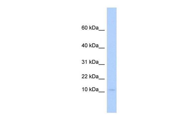 PLAC9 Antibody in Western Blot (WB)