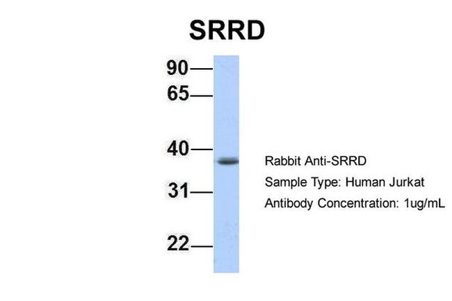 SRRD Antibody in Western Blot (WB)