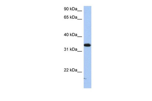 SULT6B1 Antibody in Western Blot (WB)