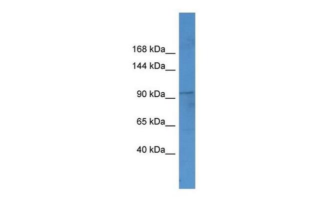 FTSJ3 Antibody in Western Blot (WB)