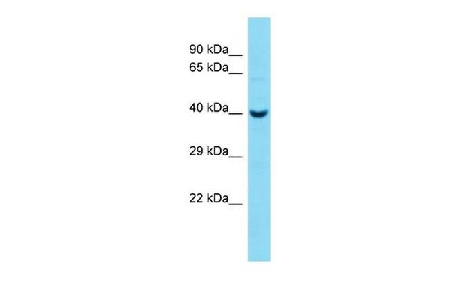 PCMTD2 Antibody in Western Blot (WB)