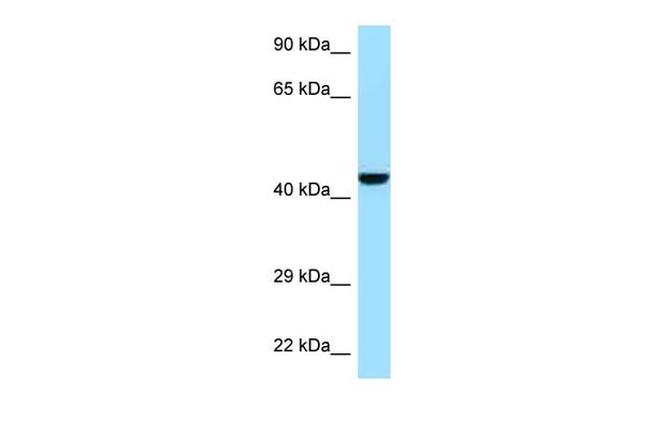 GMPPB Antibody in Western Blot (WB)