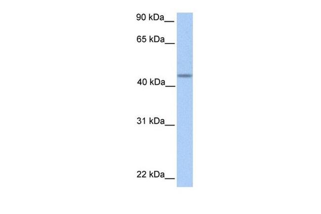 PNPLA5 Antibody in Western Blot (WB)