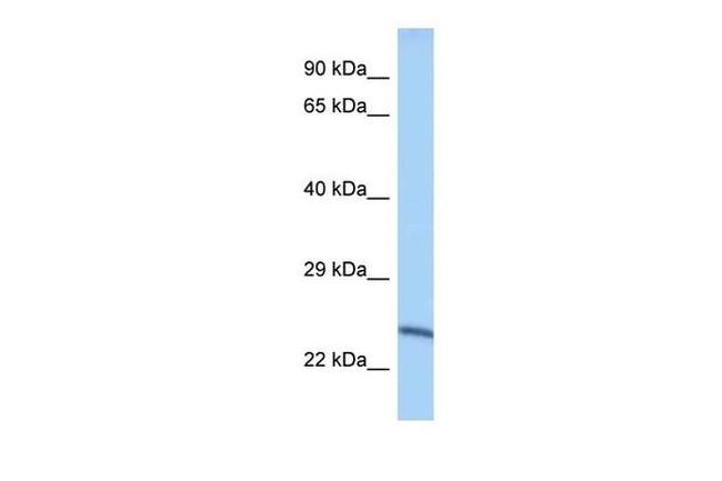 METTL10 Antibody in Western Blot (WB)