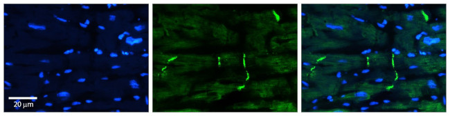 PERP Antibody in Immunocytochemistry (ICC/IF)
