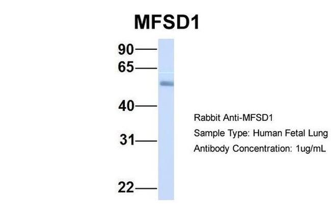 MFSD1 Antibody in Western Blot (WB)