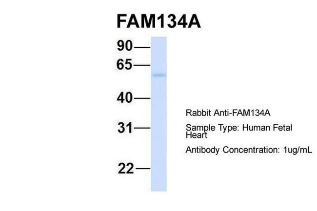 FAM134A Antibody in Western Blot (WB)