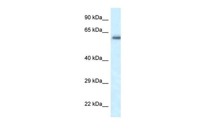 FRMD5 Antibody in Western Blot (WB)