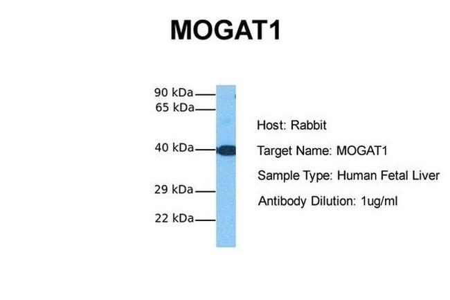 MOGAT1 Antibody in Western Blot (WB)