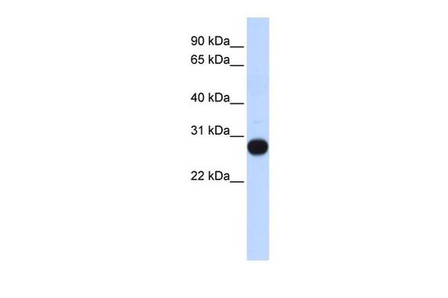 TCEAL4 Antibody in Western Blot (WB)