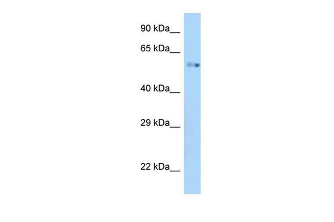 ZIK1 Antibody in Western Blot (WB)