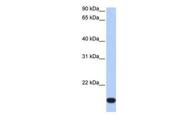 ZNF826P Antibody in Western Blot (WB)