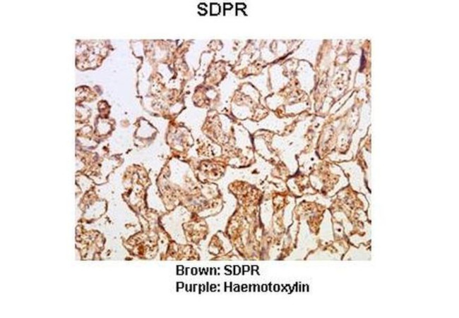 SDPR Antibody in Immunohistochemistry (IHC)