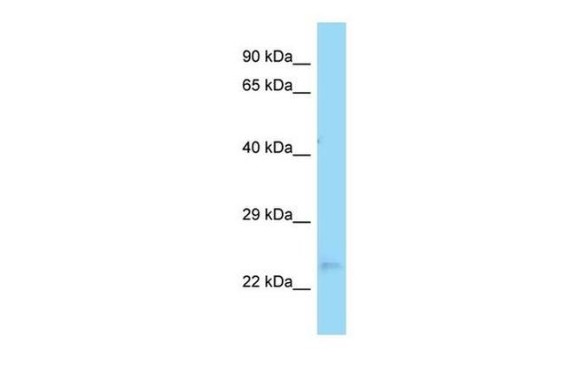 OVCA2 Antibody in Western Blot (WB)