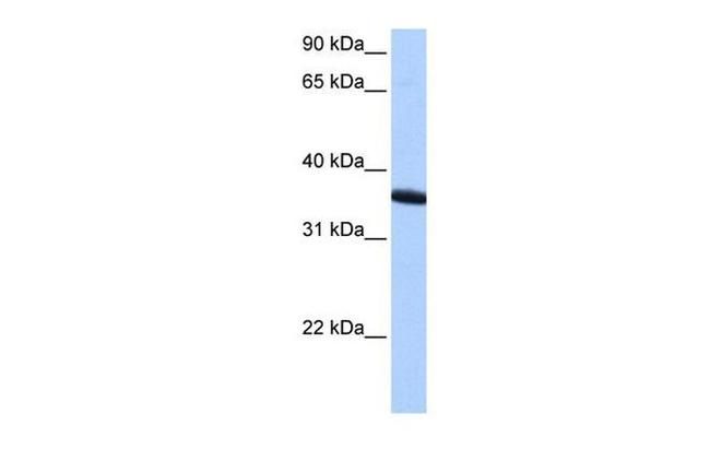 ZNF192P1 Antibody in Western Blot (WB)