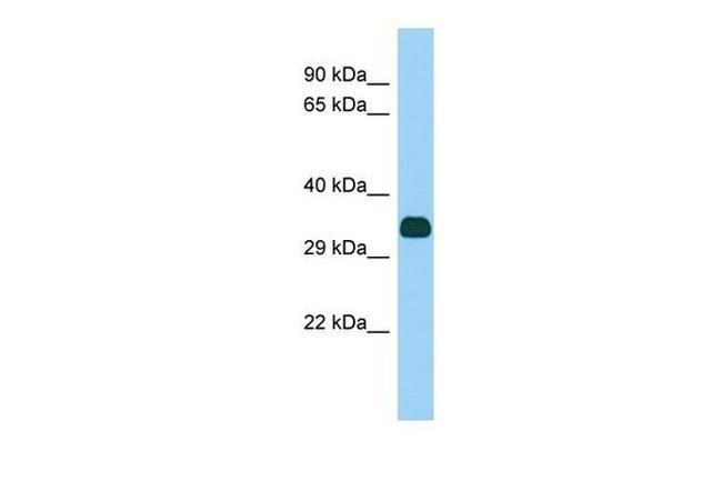FANK1 Antibody in Western Blot (WB)