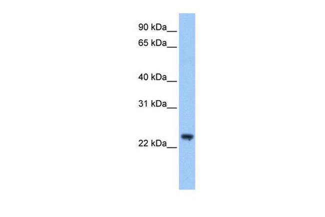TRIM48 Antibody in Western Blot (WB)