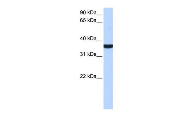TP53I13 Antibody in Western Blot (WB)