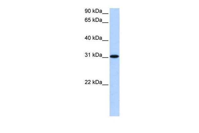 TNRC18B Antibody in Western Blot (WB)