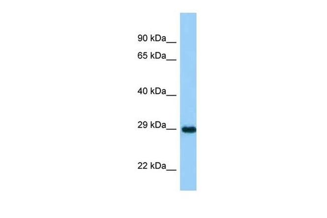 ASB11 Antibody in Western Blot (WB)