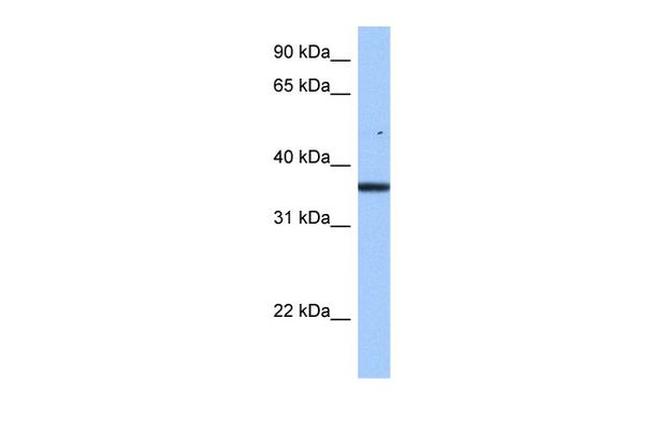 FAM153B Antibody in Western Blot (WB)