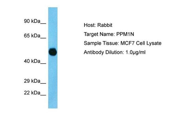 PPM1N Antibody in Western Blot (WB)