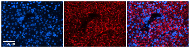 OVCA1 Antibody in Immunocytochemistry (ICC/IF)
