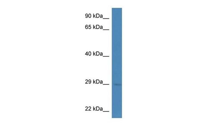 CELA1 Antibody in Western Blot (WB)