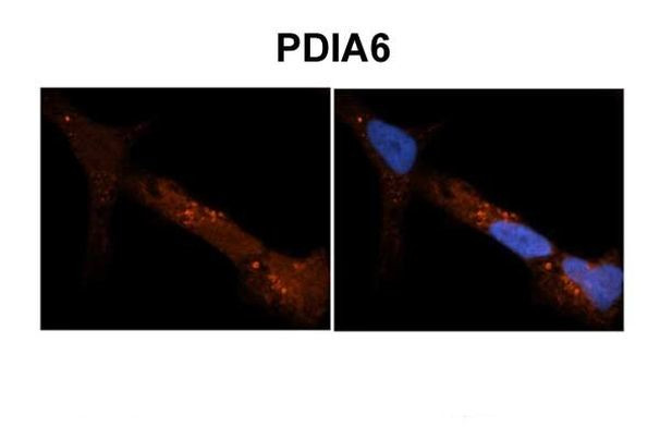 PDIA6 Antibody in Immunohistochemistry (IHC)
