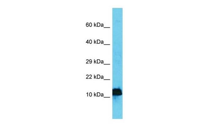 AP4S1 Antibody in Western Blot (WB)