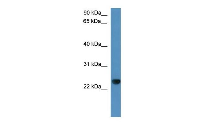 CAPSL Antibody in Western Blot (WB)
