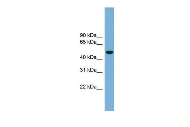 UBQLNL Antibody in Western Blot (WB)