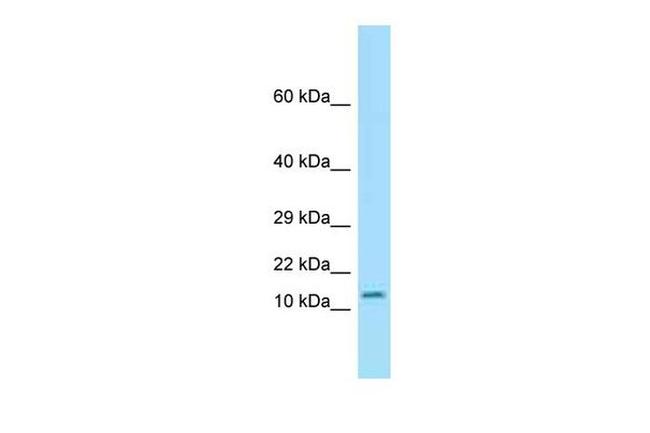 Otos Antibody in Western Blot (WB)