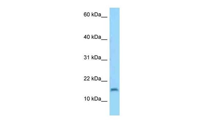 C3orf22 Antibody in Western Blot (WB)