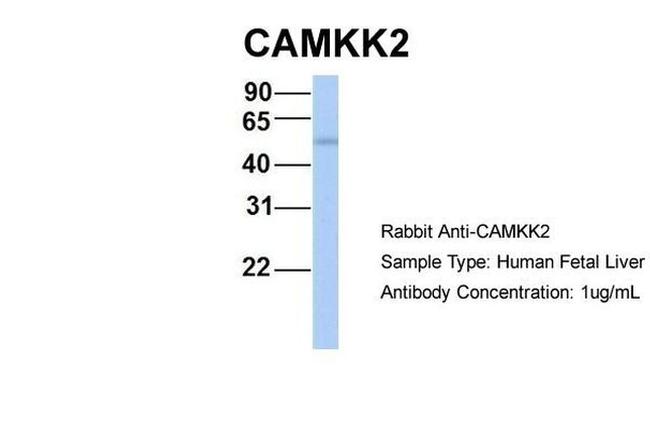CaMKK beta Antibody in Western Blot (WB)