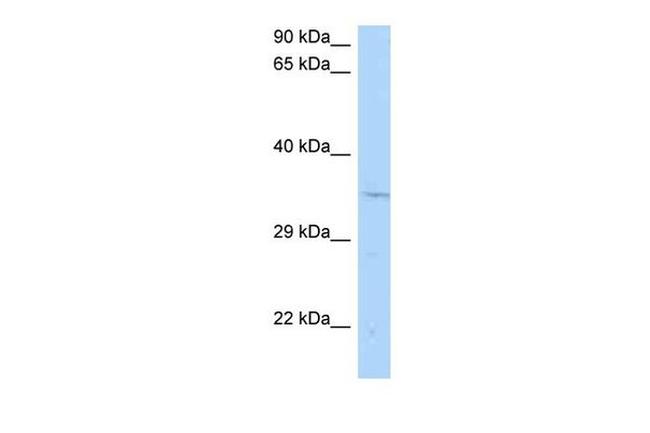 CNTD1 Antibody in Western Blot (WB)