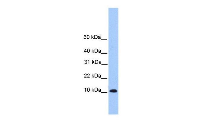 TRAPPC6B Antibody in Western Blot (WB)