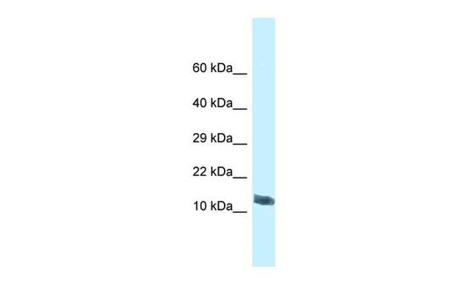 MORN4 Antibody in Western Blot (WB)
