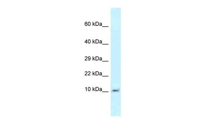 MRPL55 Antibody in Western Blot (WB)