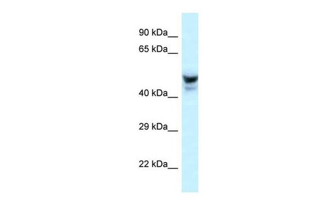 PHACTR3 Antibody in Western Blot (WB)