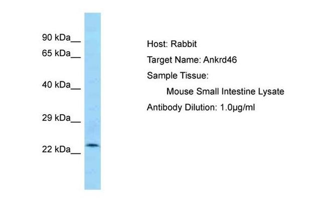 ANKRD46 Antibody in Western Blot (WB)