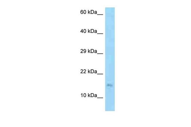 EDDM3B Antibody in Western Blot (WB)