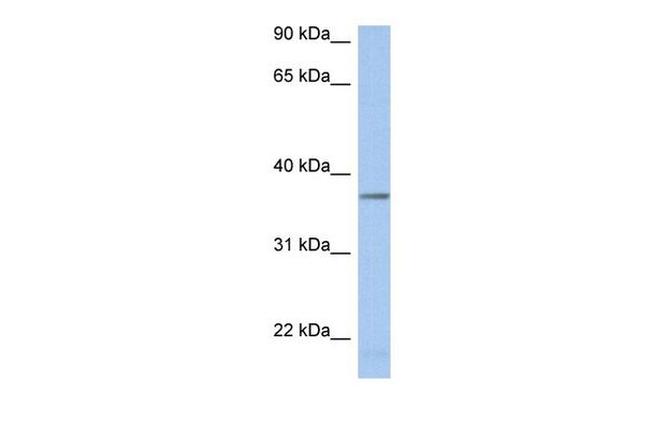 LDHAL6B Antibody in Western Blot (WB)